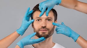 Masculinisation du visage par injection d'acide hyaluronique à Saint Germain en Laye