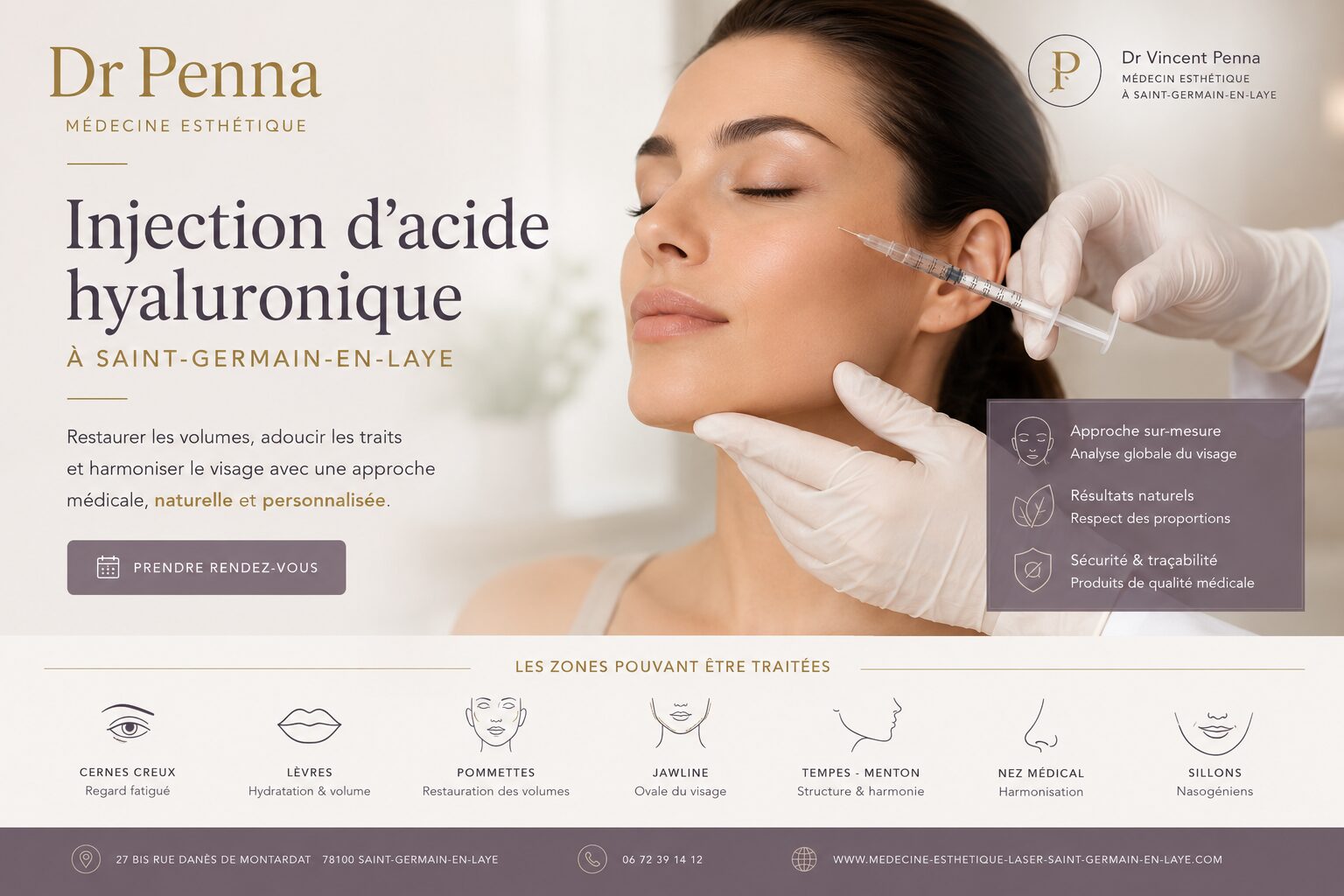 Injection d’acide hyaluronique du visage au cabinet du Dr Vincent Penna à Saint-Germain-en-Laye