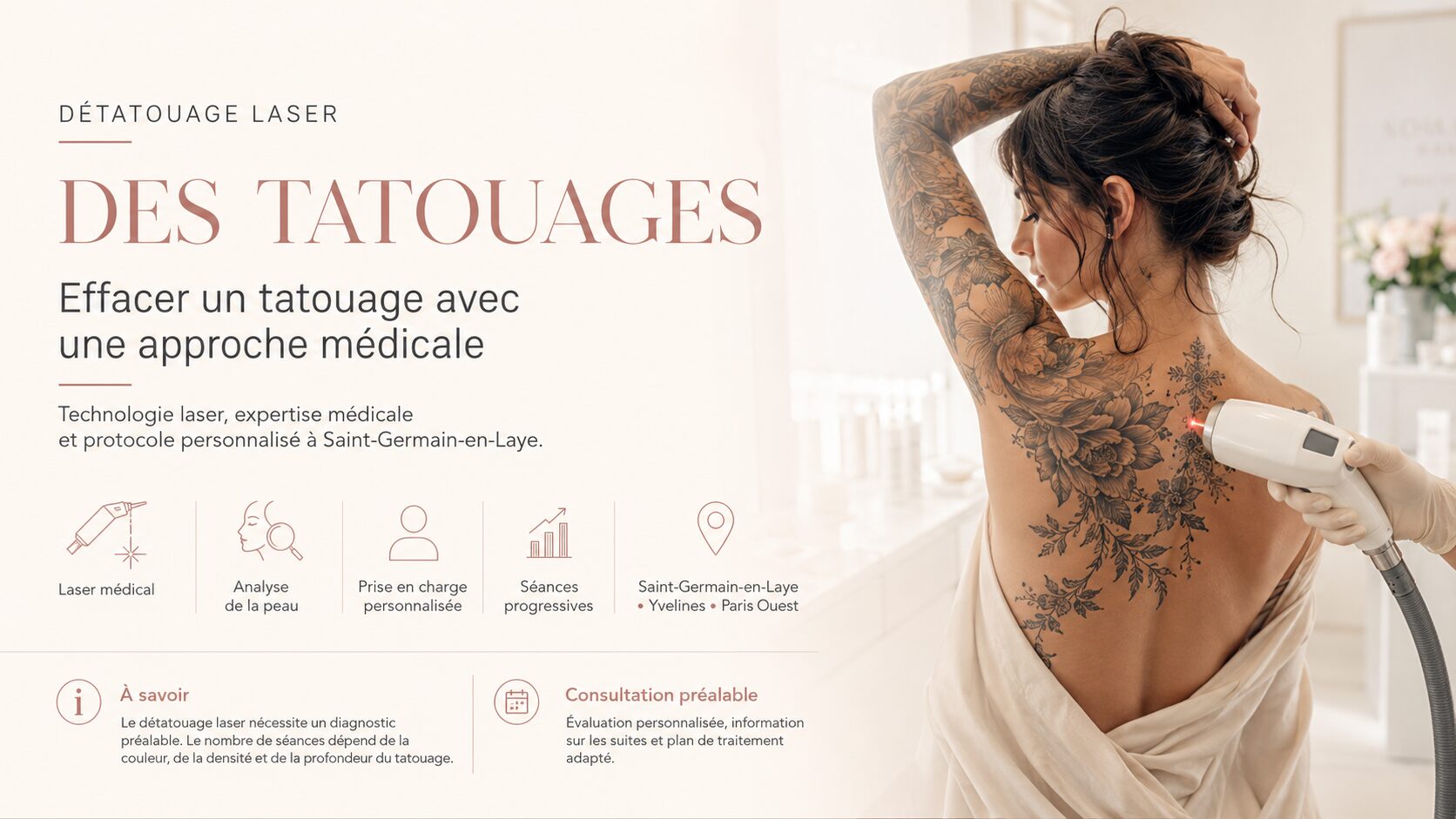 Détatouage laser médical d’un tatouage à Saint-Germain-en-Laye avec protocole personnalisé